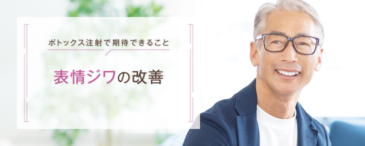 ボトックス_表情ジワ