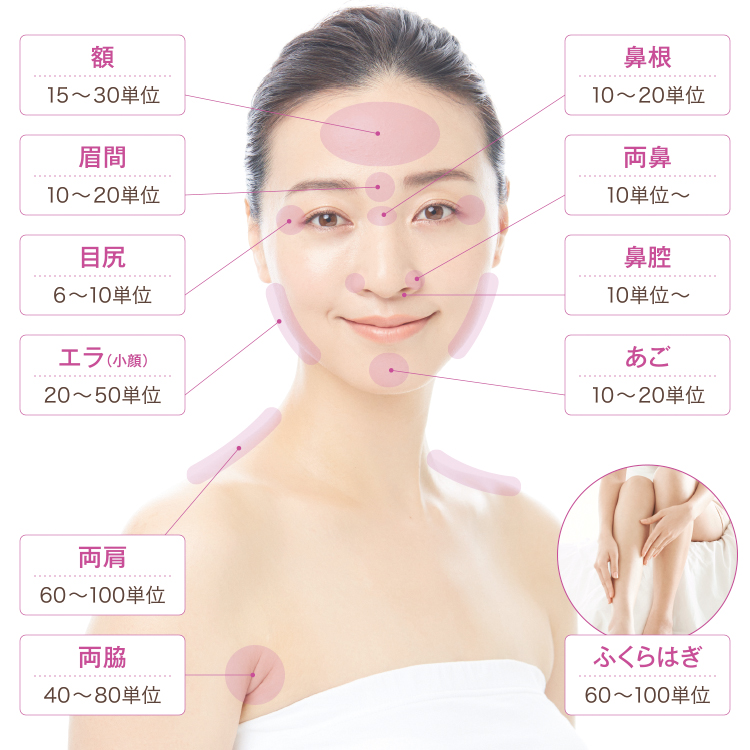ボトックス_注入部位と単位数
