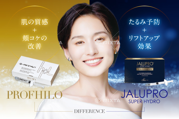 プロファイロとの違い