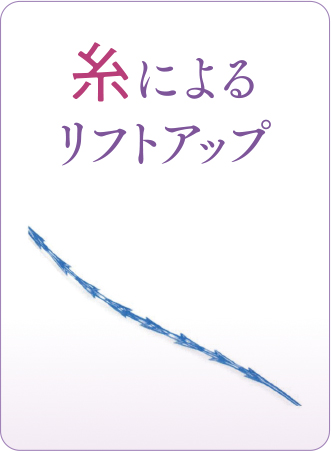 糸によるメニュー_ボタン