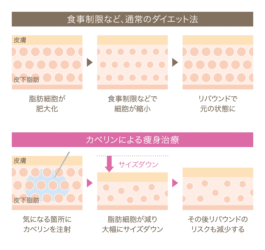 カベリン説明図