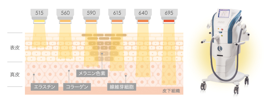 M22説明図