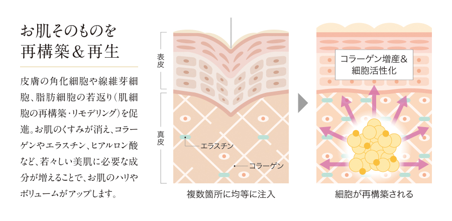 肌の断面図