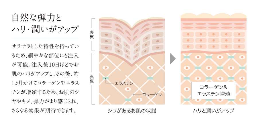 肌の断面図