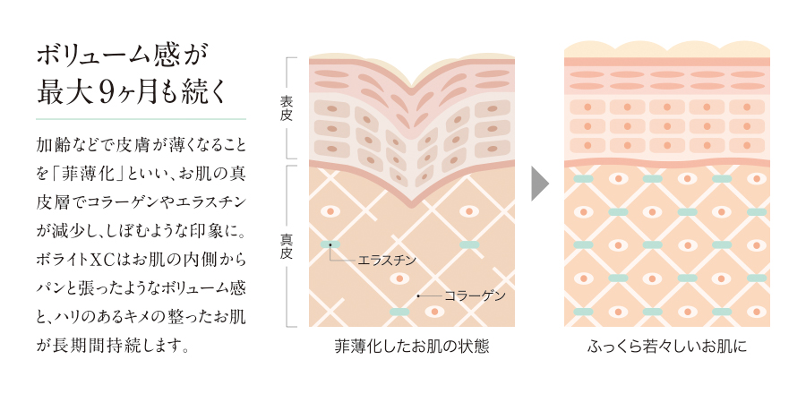 肌の断面図