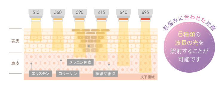 M22_図