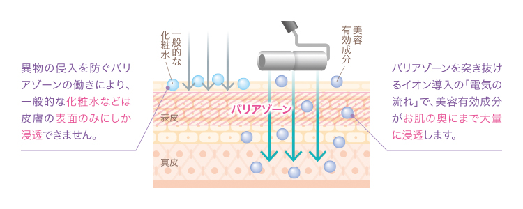 イオン導入_図