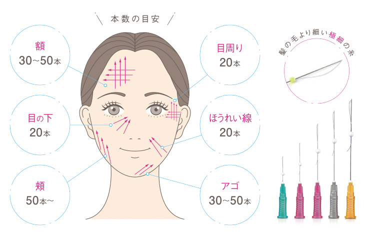 鍼と適用範囲