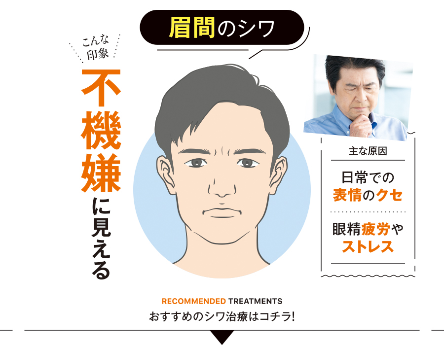 イラスト_眉間のシワ