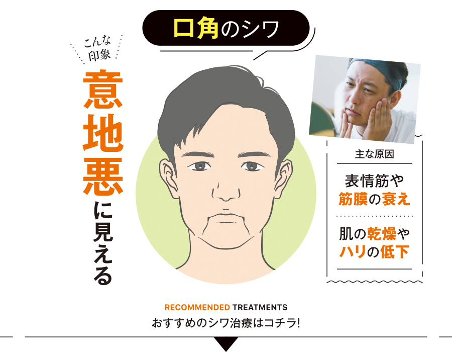 イラスト_口角のシワ