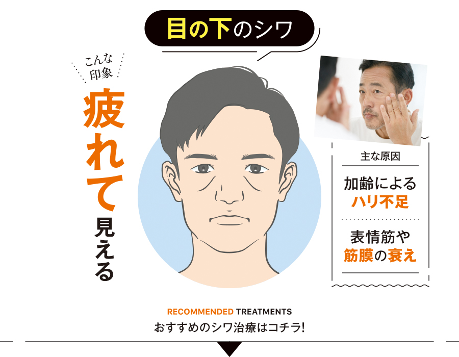 イラスト_目の下のシワ