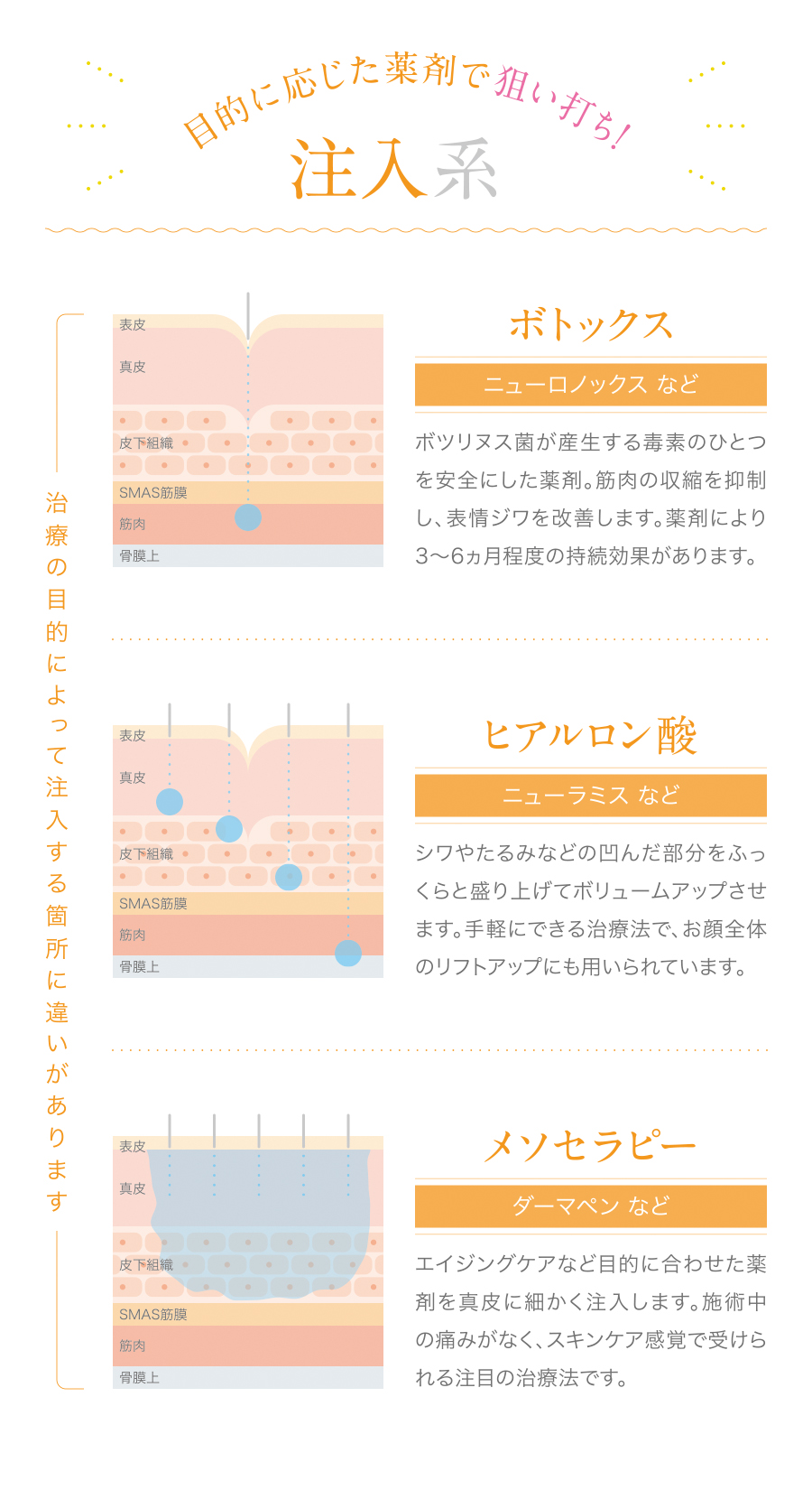 注入系の表