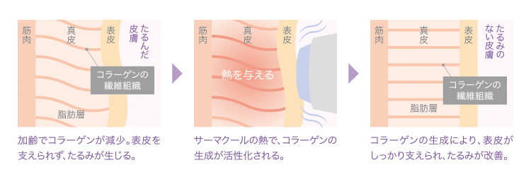 サーマクールの説明図